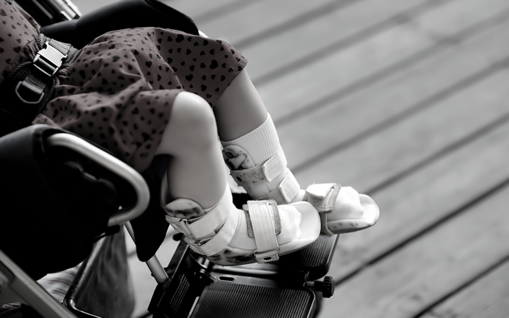 A little girl with cerebral palsy sits in her wheelchair.