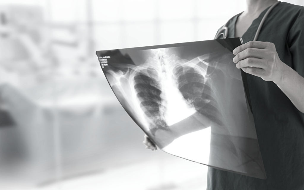 Nurse holds blood clot x-ray in hands.