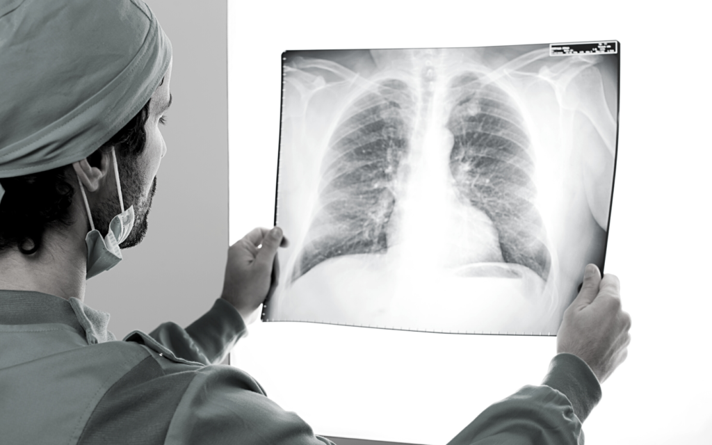 Doctor looks at imaging of patient's lungs.