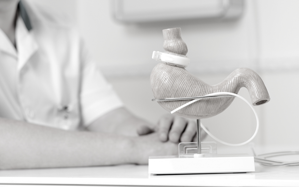 Weight Loss Surgery Went Wrong? Lap Band Erosion Lawsuits & More