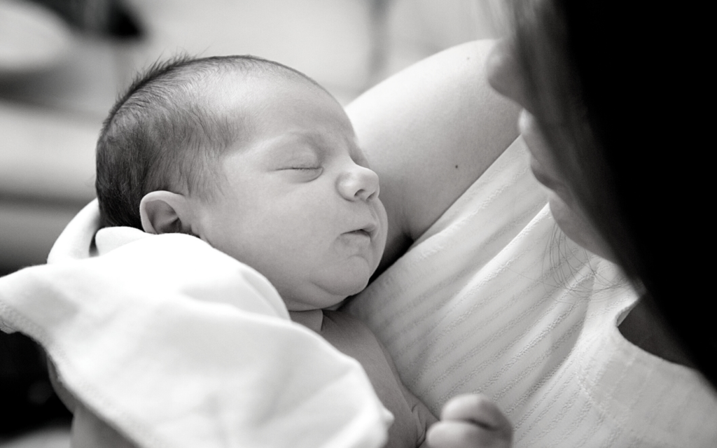 Mother holds baby with birth injury.