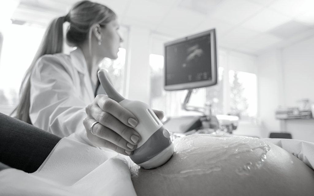 A technician performs an ultrasound on a pregnant woman's belly. 
