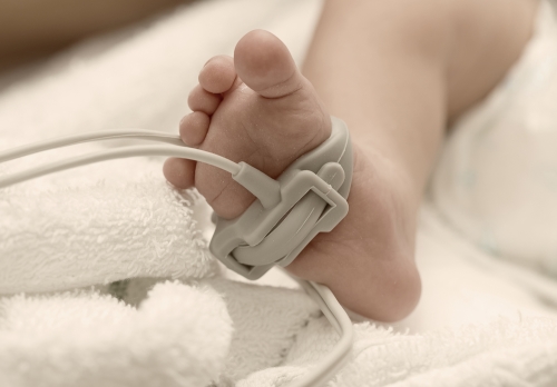 Baby's foot on a white towel, with a medical device attached to it.