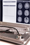 Brain x-rays on laptop screen with a stethoscope lying across the keyboard
