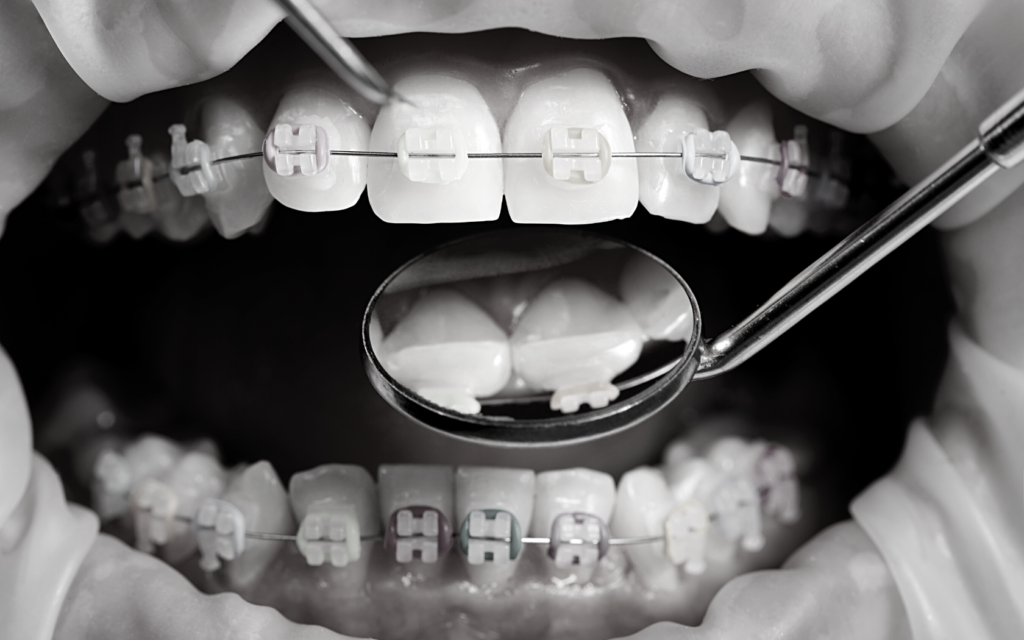 Orthodontist examines patient's mouth.