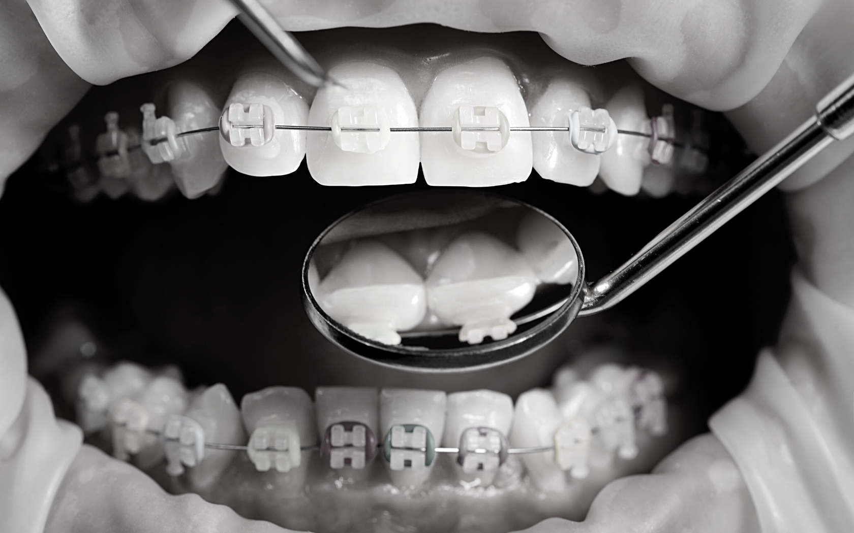 Can You Sue the Orthodontist for Malpractice? In Many Cases, Yes.