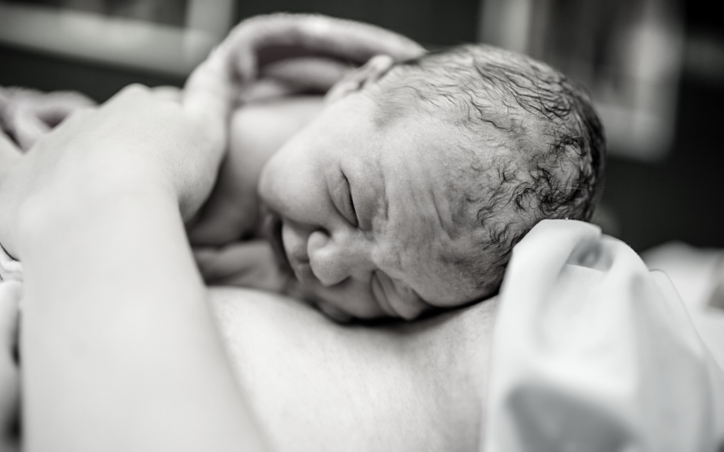 Newborn baby after vacuum delivery.