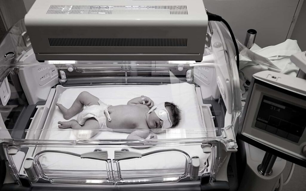 Jaundice-Brain-Injury