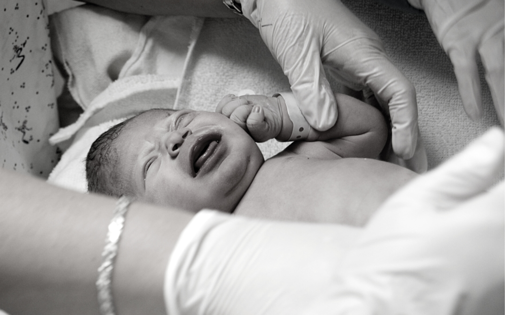 Baby with large birth weight is more prone to Erb's Palsy injury.