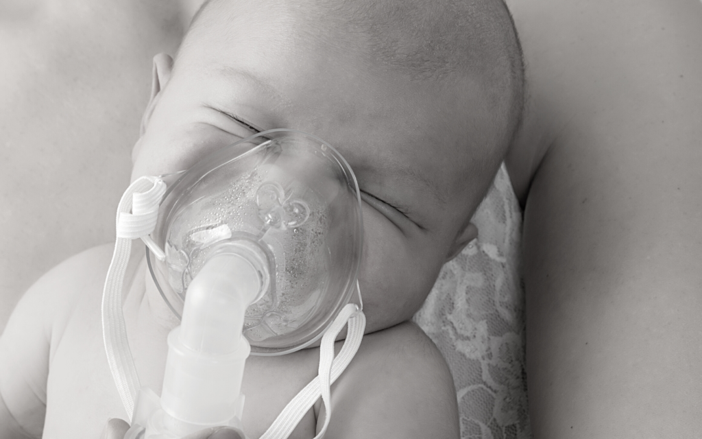 Baby wearing oxygen mask because of prolapsed cord complications.