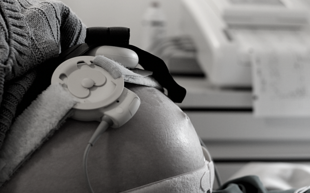 Fetal bradycardia monitoring during labor .
