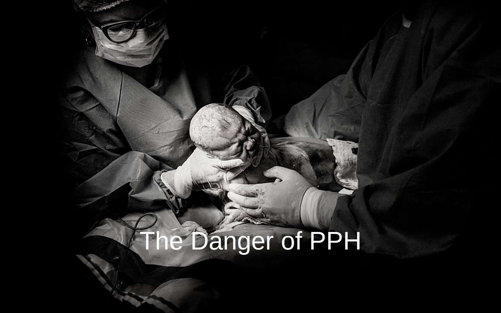 PPH can occur after a C-section as well as vaginal delivery.