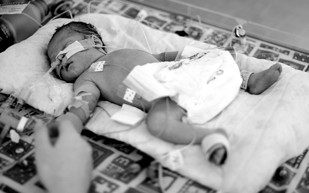 A baby suffers injuries because of Pitocin negligence.
