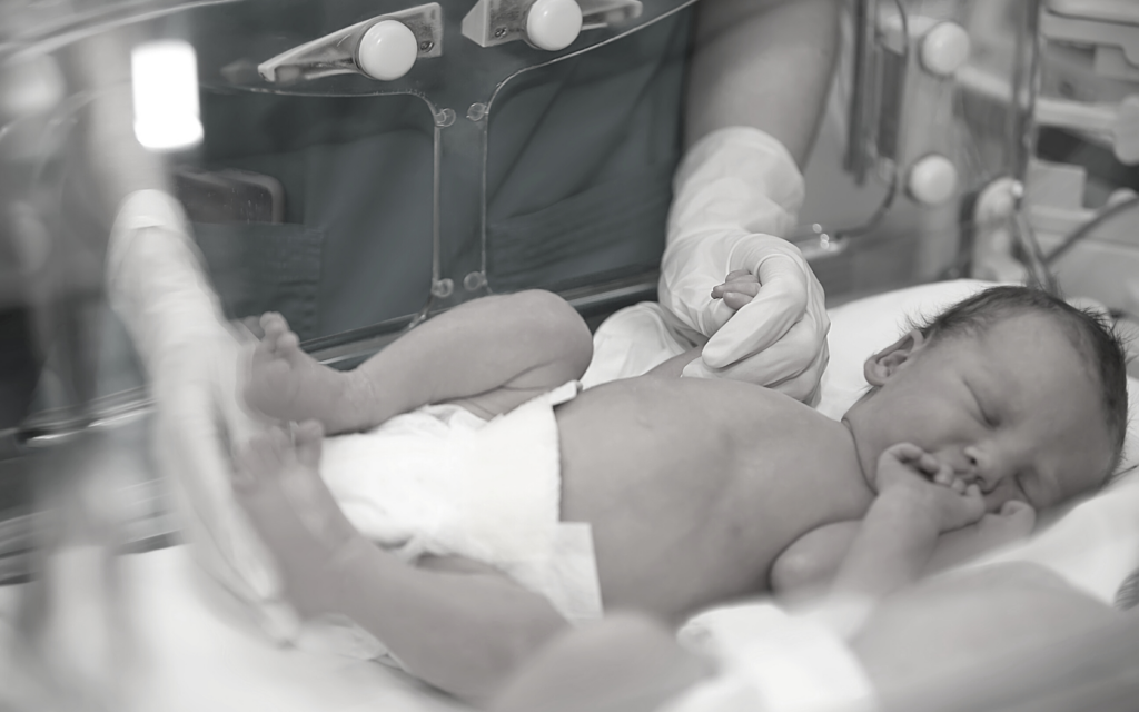 Newborn recovering from forceps birth injury.