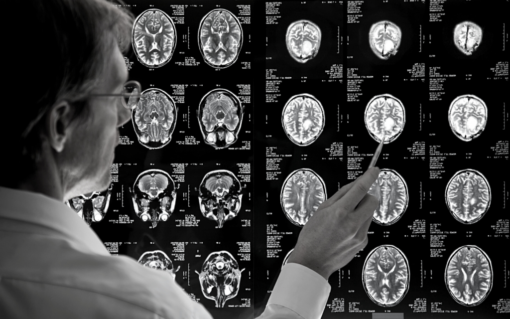 Radiologist views brain scan.