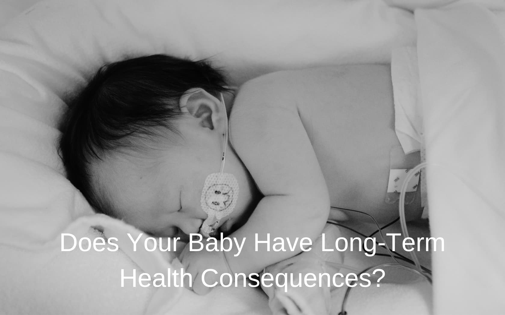 Nuchal-Cord-Complications