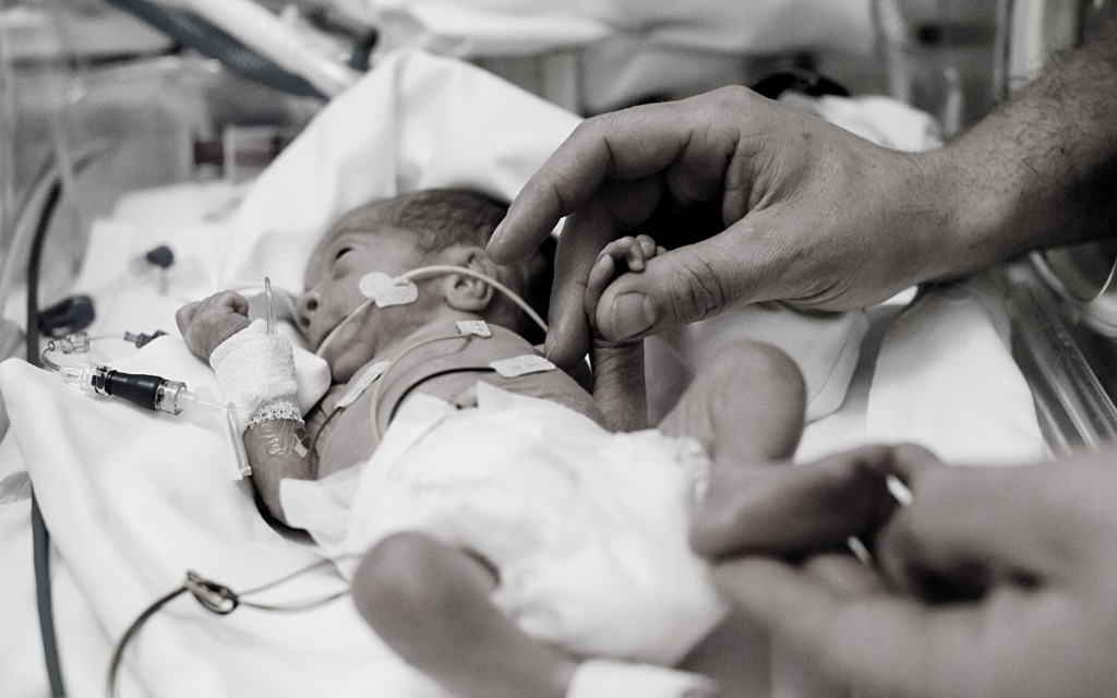Baby in hospital due to meconium aspiration complications. 