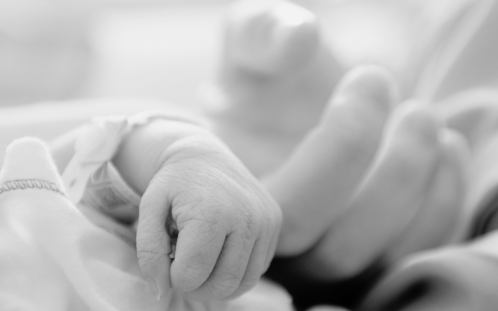 Newborn in hospital for untreated jaundice.