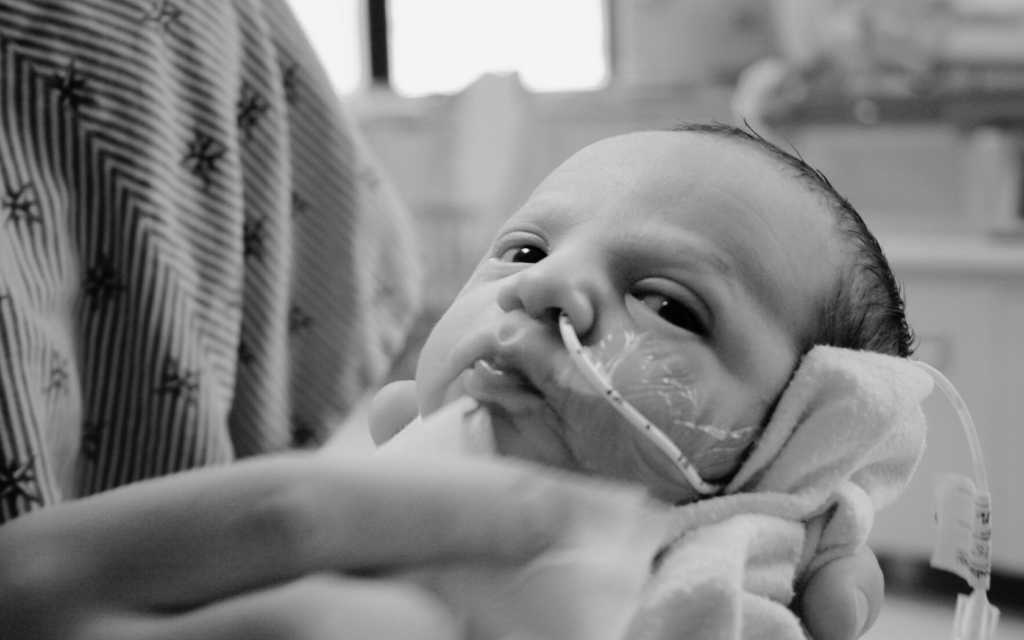 Baby in NICU because of malpractice complications.