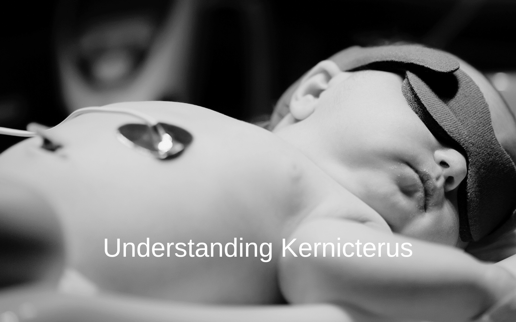 A newborn baby wears eye protection while receiving treatment for kernicterus.