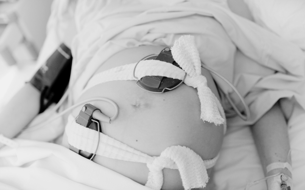 Pregnant woman in labor with monitoring equipment placed on her belly, tracking contractions and fetal hearteat.