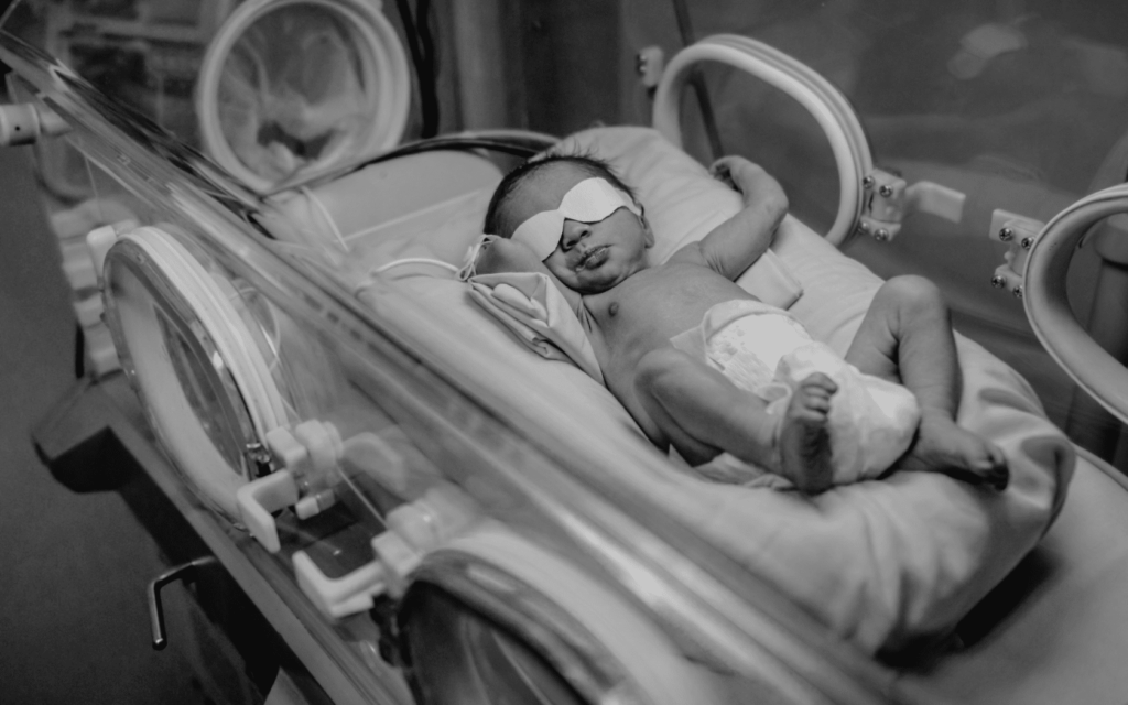 A baby undergoes treatment in hospital.