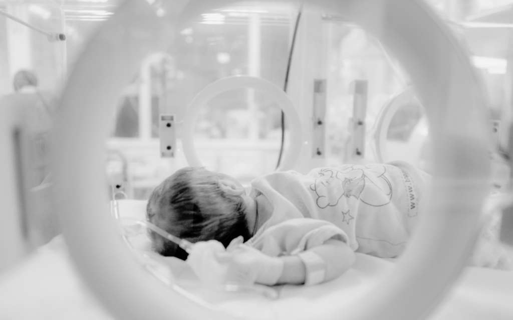 Baby in NICU for birth asphyxia injury during childbirth.