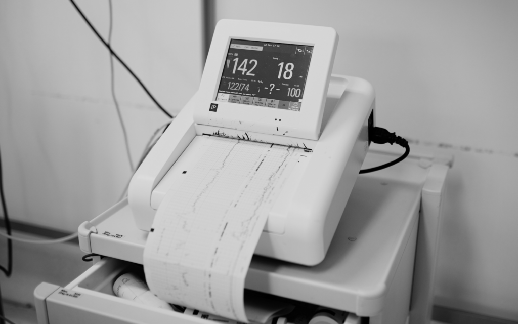 Baby's vital signs captured on fetal monitoring strips.