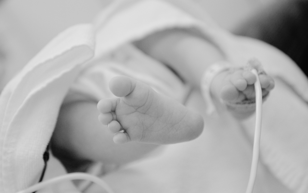 Newborn in NICU receiving medical care with equipment hooked up.