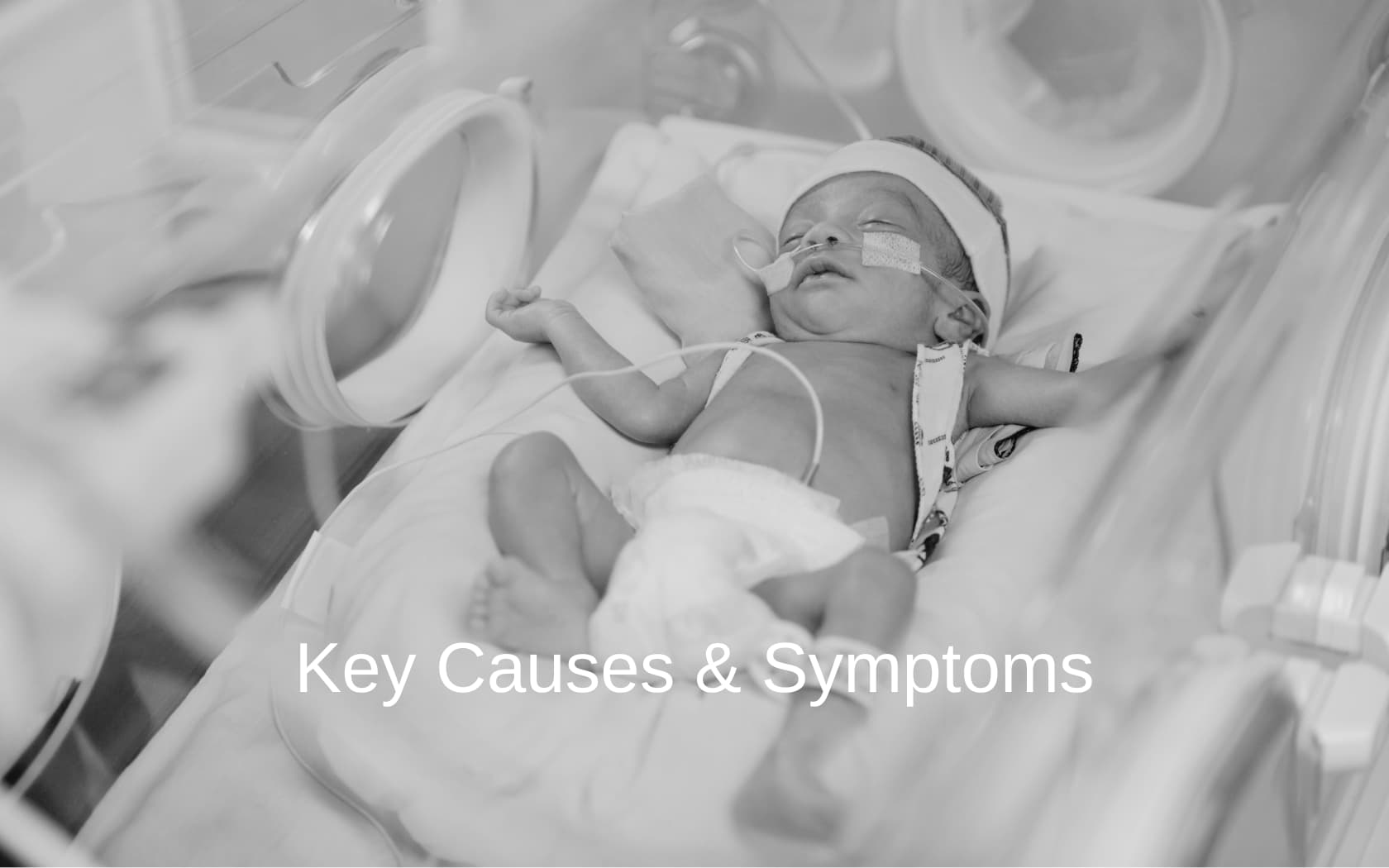 Baby with Periventricular Leukomalacia