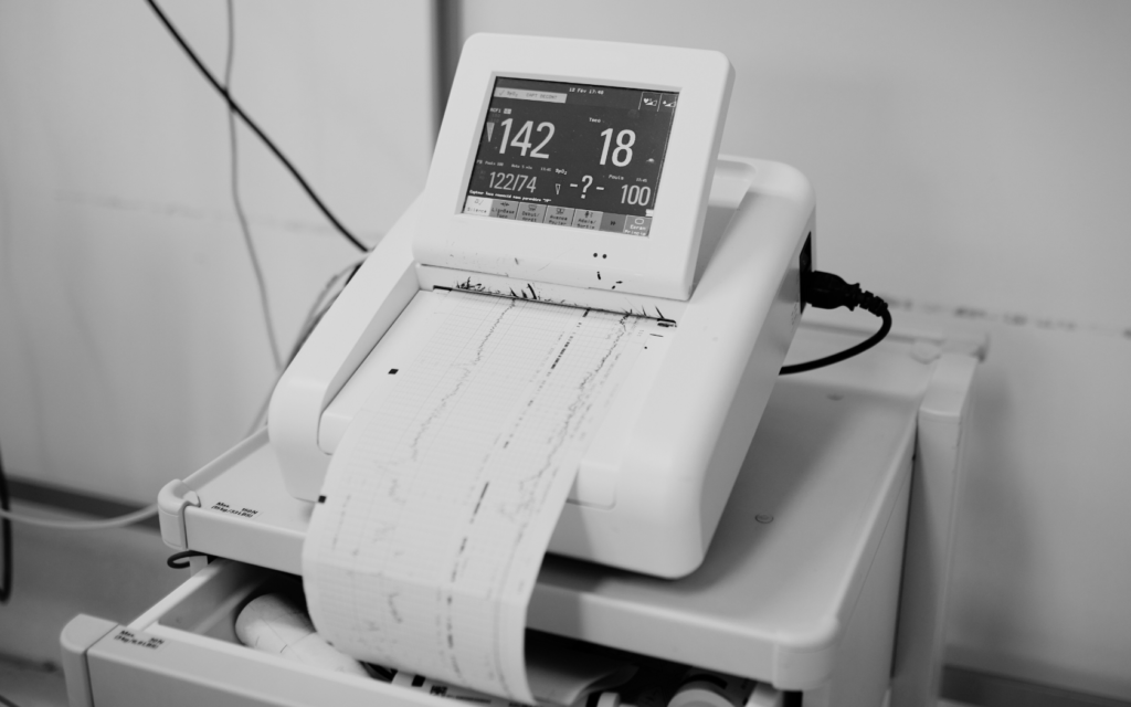 Fetal monitoring strips being printed out, monitoring heart rate and fetal Intolerance to labor.