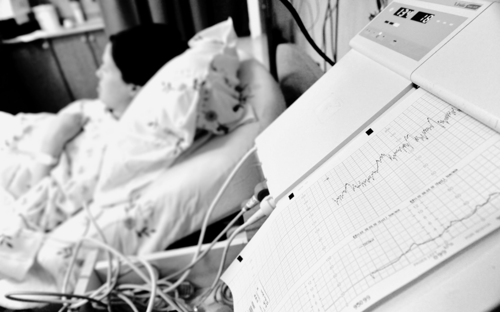 Fetal heart rate monitor showing baby's heart readings during childbirth.