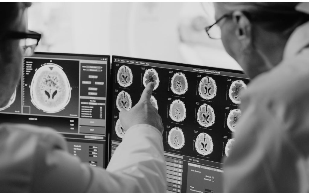 Medical scan of a baby's brain showing signs of damage.