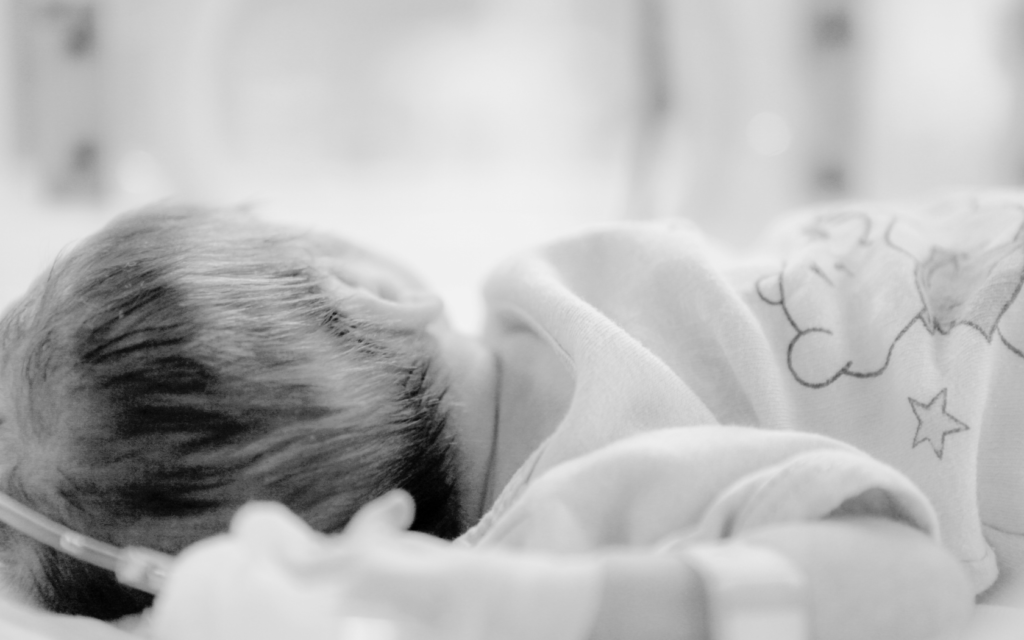 Newborn baby in the NICU, being monitored for signs of brain damage.