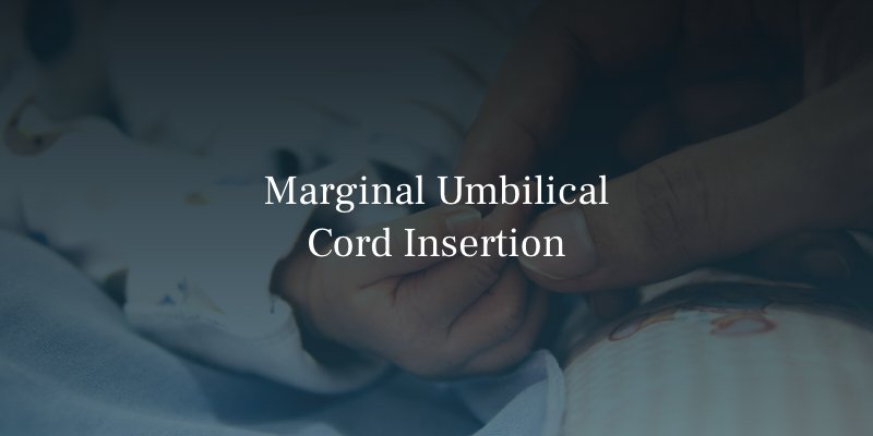 Marginal Umbilical Cord Insertion